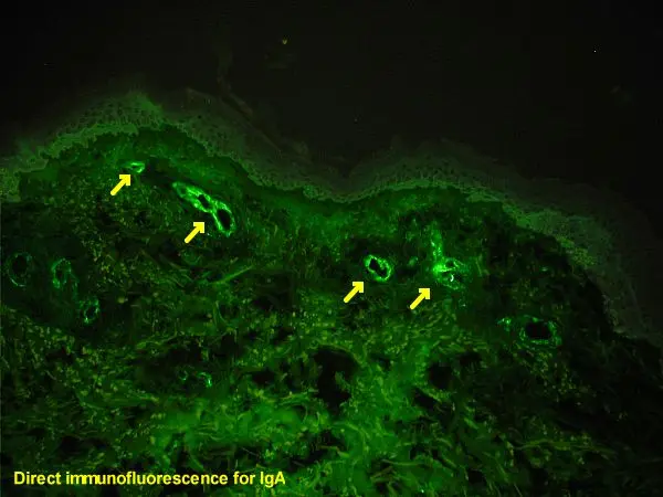 ihc