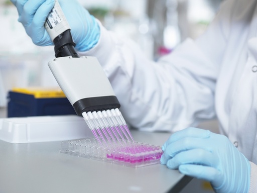 [E-25E] Rat IgE ELISA Kit   